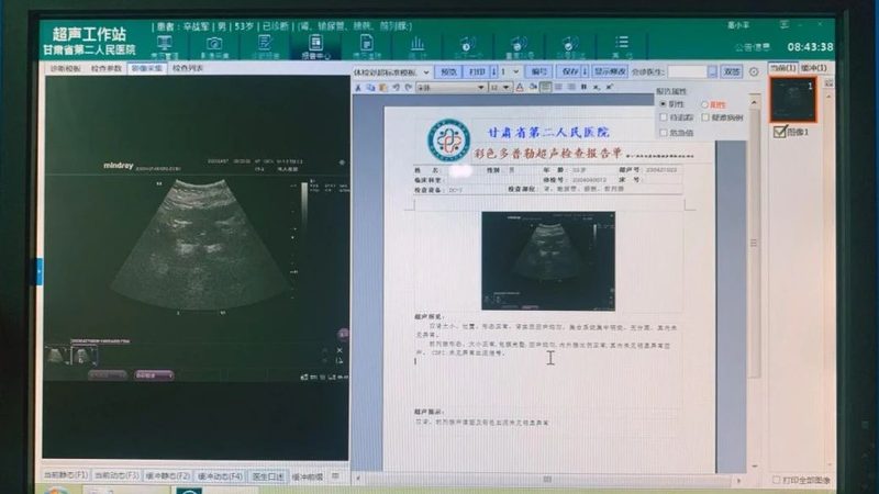 体检报告异常指标解读方法
